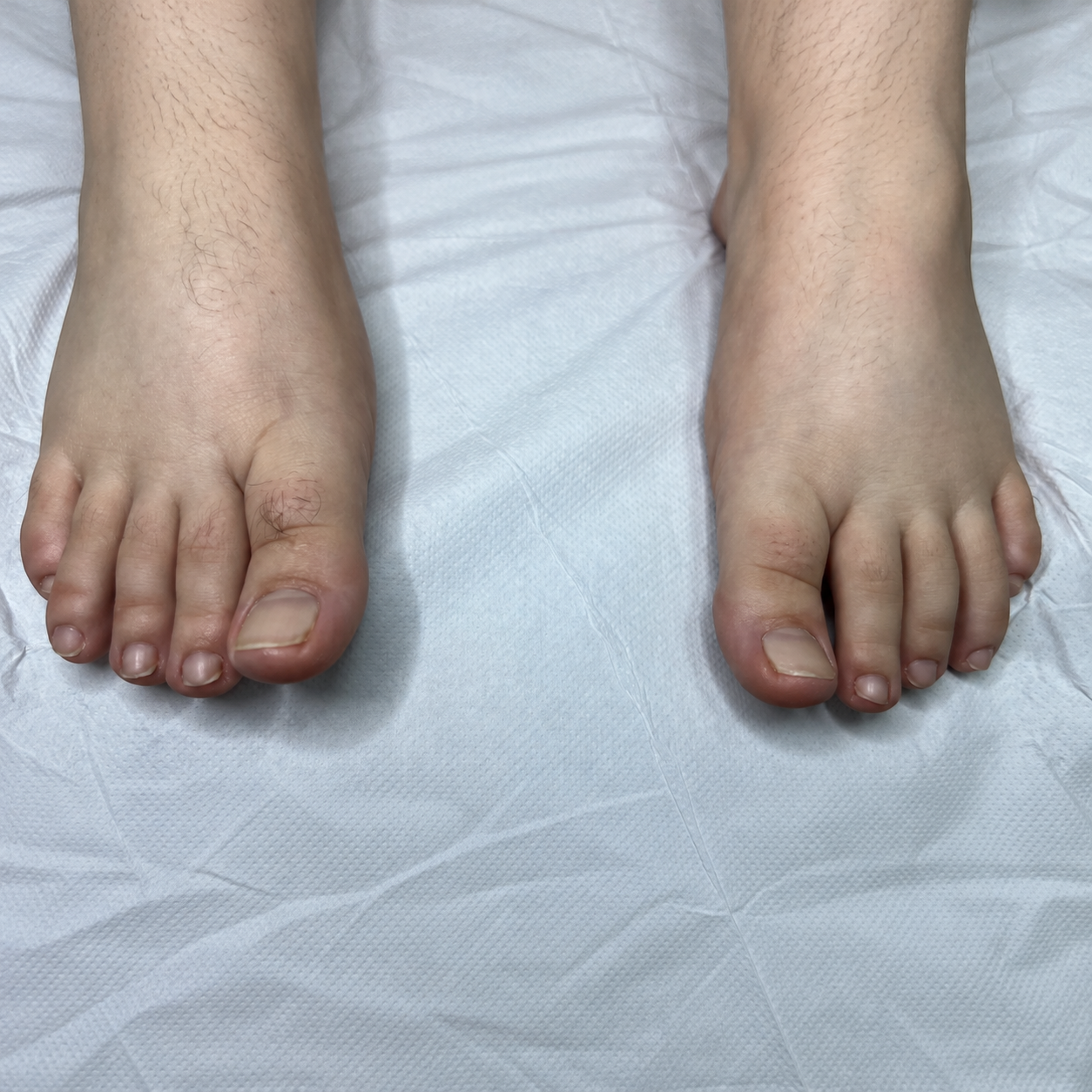 Clinical toenail documentation on gray drape-1