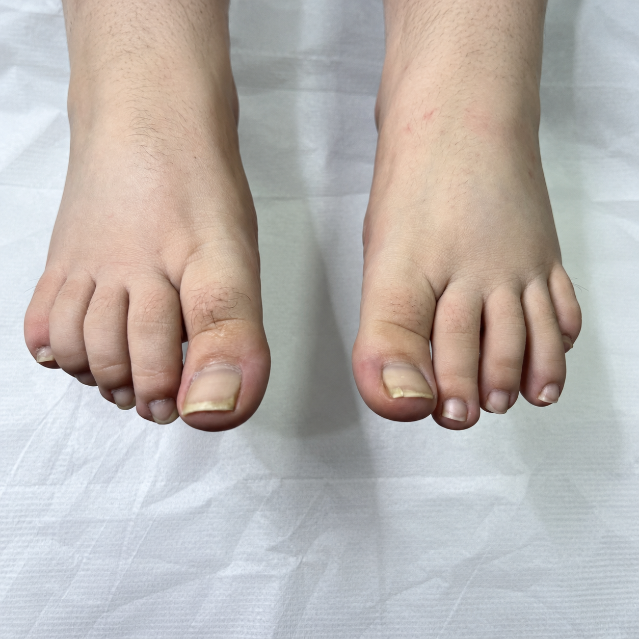 Unretouched clinical foot documentation-2